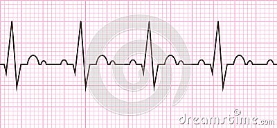 Heart beat. Cardiogram. Cardiac cycle Vector Illustration