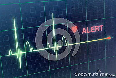 Heart beats cardiogram on the monitor. Stock Photo