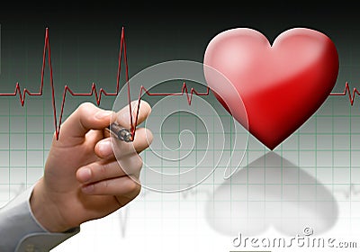 Heart cardiogram. Stock Photo