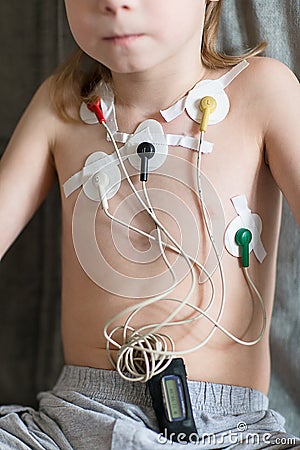 Heart cardiogram using Holter Stock Photo