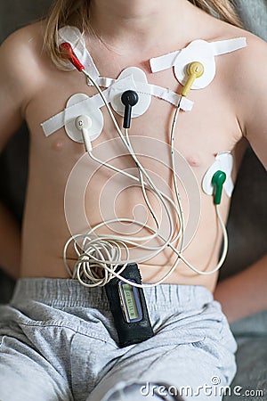 Heart cardiogram using Holter Stock Photo