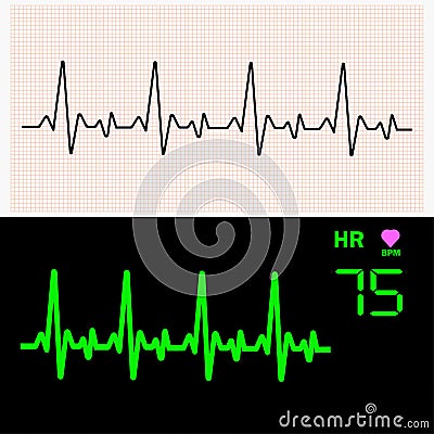 Heart cardiogram waves on graph paper and on monitor. Vector illustration. Vector Illustration