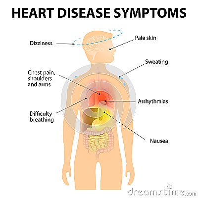 Heart Disease Symptoms Vector Illustration