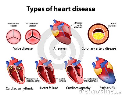 Heart disease Vector Illustration