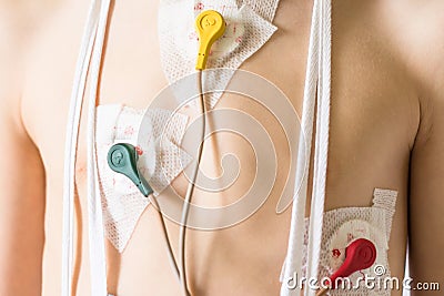 Heart electrocardiogram or monitoring using Holter for young patient Stock Photo