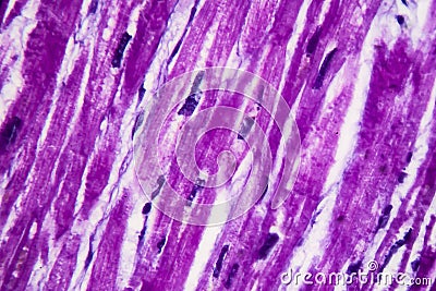 Heart hypertrophy, light micrograph Stock Photo