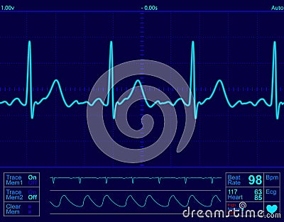 Heart monitor screen Vector Illustration