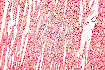Heart muscle, light micrograph Stock Photo