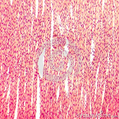 Heart muscle, light micrograph Stock Photo