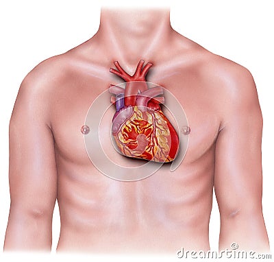 Heart - Overlaid on Male Torso, Inflamed Stock Photo