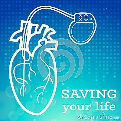 Heart pacemaker body Vector Illustration