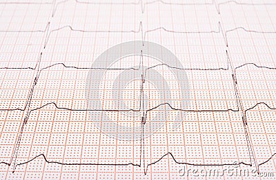 Heart rhythm chart Stock Photo