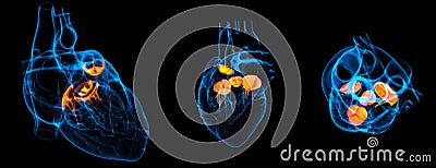 Heart valve Cartoon Illustration