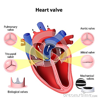 Heart valve surgery Vector Illustration