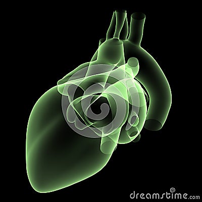 Heart X-Ray 2 Stock Photo