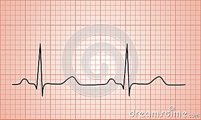 Heartbeat Normal ECG graph Stock Photo