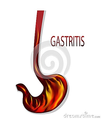 Heartburn, gastritis Vector Illustration