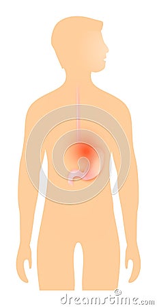 Heartburn or stomach disease Vector Illustration