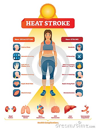 Heat stroke vector illustration. Exhaustion symptoms labeled medical list. Vector Illustration