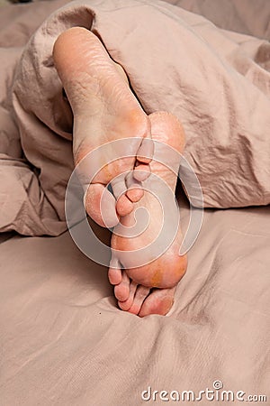 heel in the cracks of the smears on the legs woman foot lotion moisturizing hand dermatitis, sole moisturizer Stock Photo