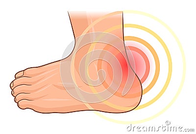 Heel pain Vector Illustration