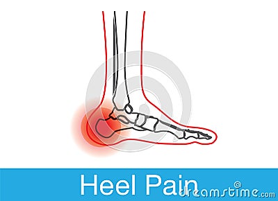 Heel pain outline Vector Illustration