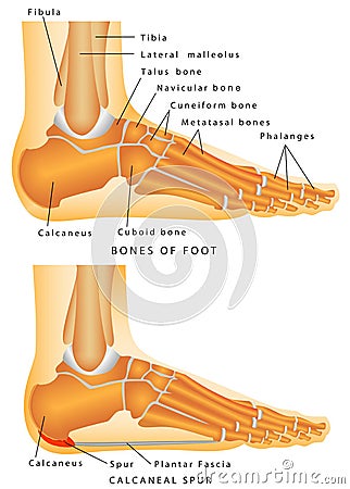 Heel Spur. Stock Photo