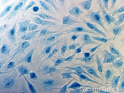 HeLa cervical cancer cells Stock Photo