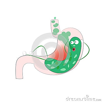 Helicobacter bacteria in the human stomach. Diseases gastrointestinal tract Vector Illustration