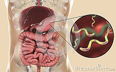 Helicobacter pylori, bacterium colonizing stomach Cartoon Illustration