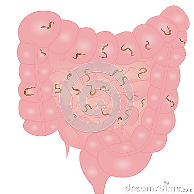 Helminths in intestine Vector Illustration