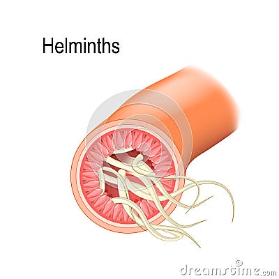 Helminths in the Small intestine. Vector Illustration