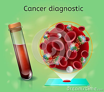 Hematologic Research for Early Cancer Diagnostic Vector Illustration