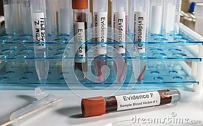 Hematological analysis with forensic test kit in a murder in a crime lab Stock Photo