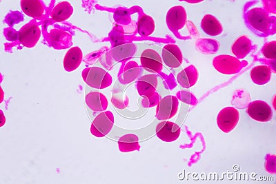 Hemerocallis citrina mature anther under the microscope - Abstract pink dots on white background Stock Photo