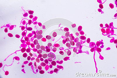 Hemerocallis citrina mature anther under the microscope - Abstract pink dots on white background Stock Photo