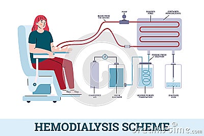 Hemodialysis or kidney dialysis scheme cartoon vector illustration isolated. Vector Illustration