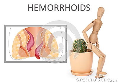 Hemorrhoids. Wooden human figure near cactus and illustration of unhealthy lower rectum on background Cartoon Illustration