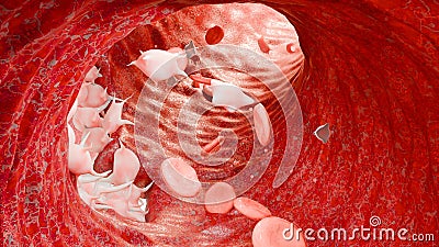 Hemostasis. Red blood cells and platelets in the blood vessel, vasoconstriction, wound healing process. hemorrhage clot Stock Photo