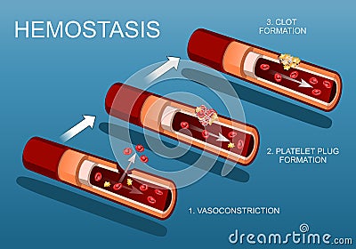 Hemostasis and Wound healing. Coagulation Vector Illustration