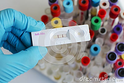 Hepatitis B antibody positive Stock Photo