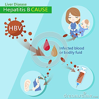 Hepatitis b cause Vector Illustration