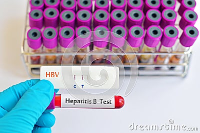 Hepatitis B testing Stock Photo