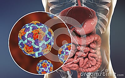 Hepatitis A viruses in small intestine Cartoon Illustration