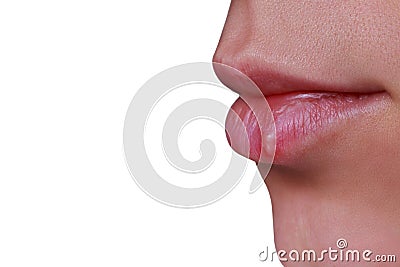 Herpes on the lips Stock Photo