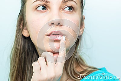 Herpes on the lips. Woman`s face with finger on lips with herpes, beauty concept Stock Photo