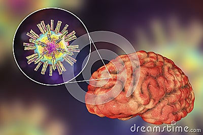 Herpes virus encephalitis, medical concept Cartoon Illustration