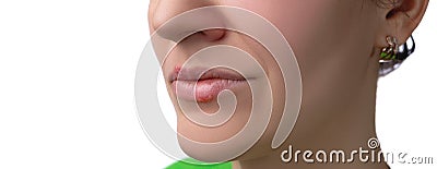 Herpes virus. Herpes disease on the lips of a 30 year old woman. Infectious virus. Close-up of the manifestation of herpes on the Stock Photo