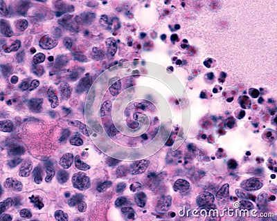 Ovary. Follicular atresia Stock Photo