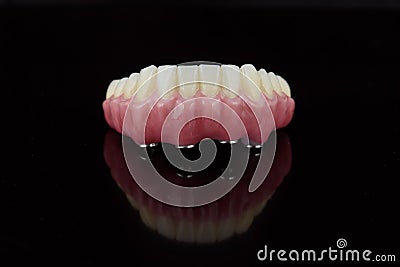 High-quality dental prosthesis made by dental technician, prosthesis with a pink gingiva to fix after implantation. Stock Photo